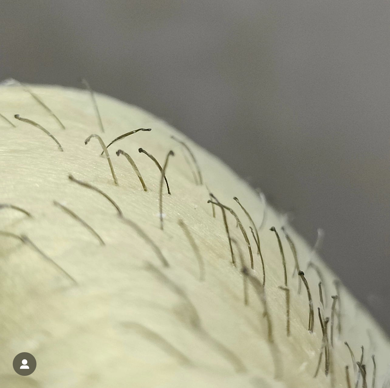 Hair Root